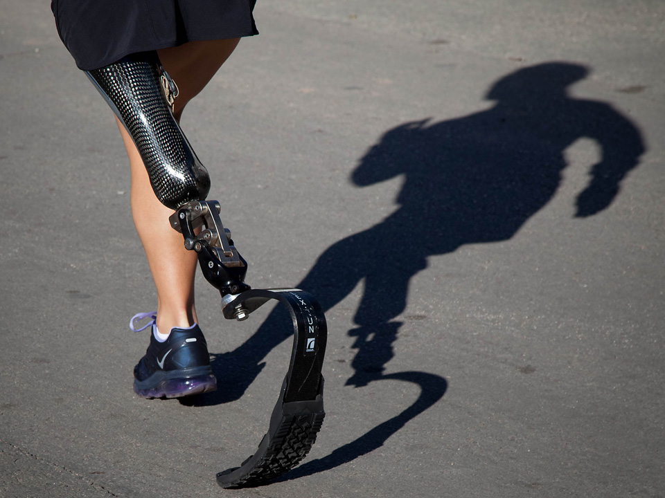 Many amputees feel ‘phantom’ pain in their non-existent limbs. 